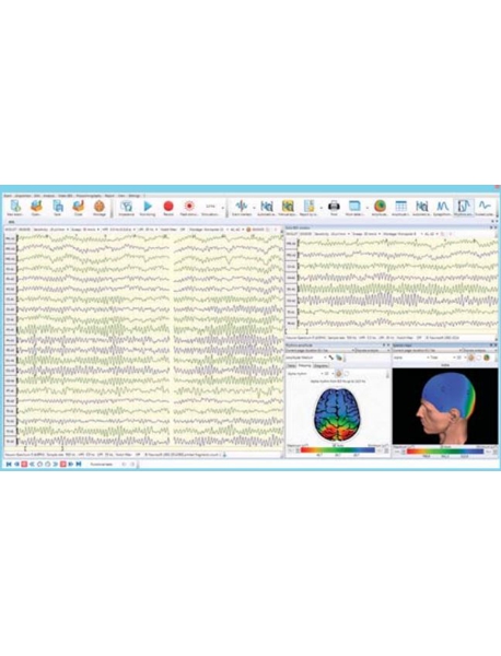 Grabador Inal&aacute;mbrico de EEG/PSG de 21 Canales Neuron-Spectrum-AM 