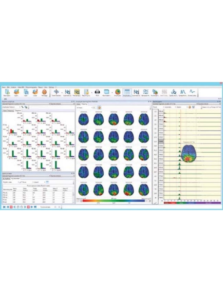 Sistema de EEG/EMG/LTM/PSG Digital de 21 Canales Neuron-Spectrum-4/EPM