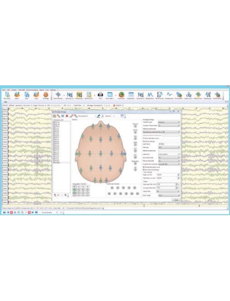 Sistema de EEG/EMG/LTM/PSG/ERG Digital de 32 Canales Neuron-Spectrum-5