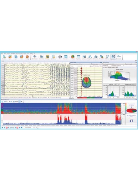 Sistema de EEG/CFM/BFB Digital de 11 Canales Neuron-Spectrum-61